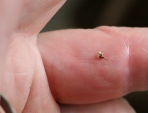 Bee sting removed